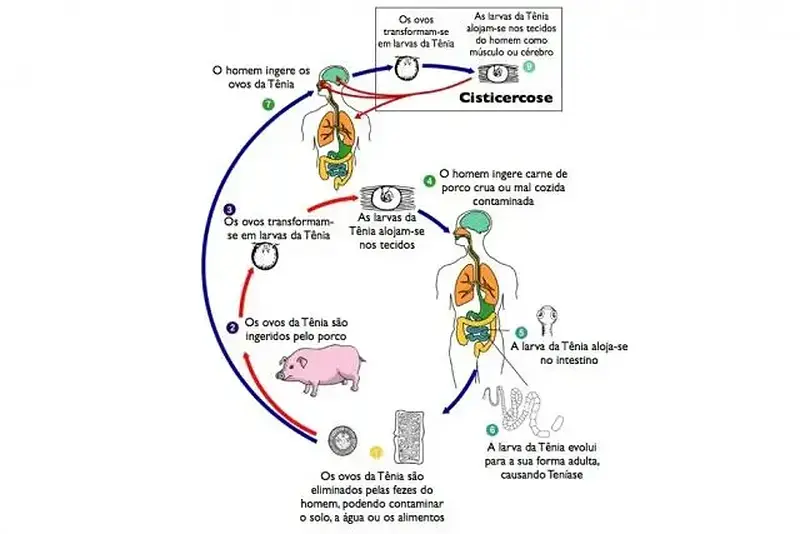 Cisticercose: A doença causada por um parasita